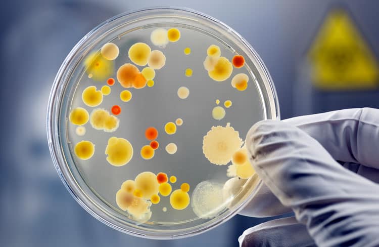 20 Coronavirus Travel Tips to Keep Your Family Safe 2 germs on a petri dish